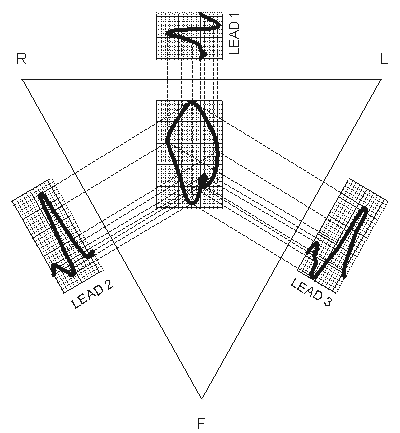 Magnify