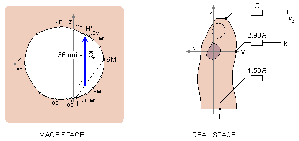 Image surface in sagittal view